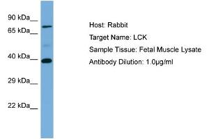 Host: Rabbit Target Name: LCK Sample Type: Fetal Muscle lysates Antibody Dilution: 1. (LCK 抗体  (N-Term))