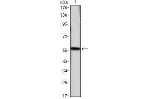 Western Blot showing CCND1 antibody used against CCND1 (AA: 1-295)-hIgGFc transfected HEK293 cell lysate. (Cyclin D1 抗体)