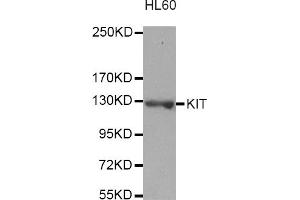 Western blot analysis of extracts of HL-60 cells, using KIT antibody (ABIN3049466). (KIT 抗体)