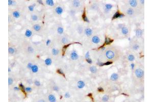 Immunohistochemistry (IHC) image for anti-CD68 Molecule (CD68) (AA 312-326), (Middle Region) antibody (ABIN3044428)