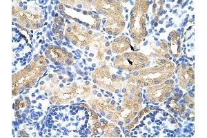 MTHFSD antibody was used for immunohistochemistry at a concentration of 4-8 ug/ml to stain Epithelial cells of renal tubule (arrows) in Human Kidney. (MTHFSD 抗体  (N-Term))