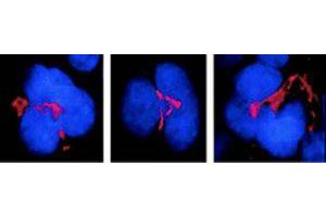 FKBP51 Immunofluorescence. (FKBP5 抗体)