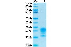 Biotinylated Human IL-17A on Tris-Bis PAGE under reduced condition. (Interleukin 17a Protein (AA 24-155) (His-Avi Tag,Biotin))