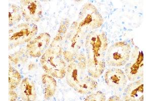 Immunohistochemistry of paraffin-embedded rat kidney using GCLC Rabbit mAb (ABIN1680604, ABIN3018993, ABIN3018994 and ABIN7101696) at dilution of 1:100 (40x lens). (GCLC 抗体)