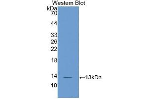 Western Blotting (WB) image for anti-Fatty Acid Binding Protein 1, Liver (FABP1) (AA 2-127) antibody (ABIN1858776) (FABP1 抗体  (AA 2-127))
