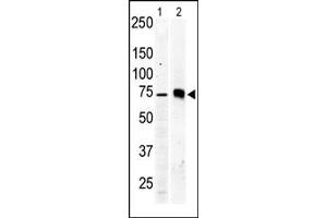 The anti-PKC beta2 Pab (ABIN391003 and ABIN2837938) is used in Western blot to detect PKC beta2 in Jurkat cell lysate (lane 1) and mouse brain tissue lysate (lane 2). (PKC beta 抗体  (C-Term))