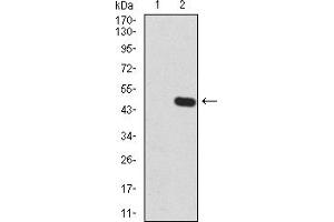 Western Blotting (WB) image for anti-Zinc Finger Protein GLI1 (GLI1) (AA 284-449) antibody (ABIN5866847) (GLI1 抗体  (AA 284-449))
