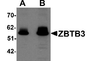 Western Blotting (WB) image for anti-Zinc Finger and BTB Domain Containing 3 (ZBTB3) (C-Term) antibody (ABIN1030811) (ZBTB3 抗体  (C-Term))