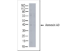 Rabbit anti Annexin A3 on human tonsil lysate (Annexin A3 抗体)
