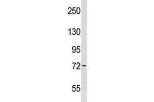 Wee1 antibody western blot analysis in WiDr lysate. (WEE1 抗体  (AA 202-230))