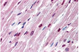 Human Heart (formalin-fixed, paraffin-embedded) stained with Tubulin, Alpha 1 (TUBA1) antibody ABIN239816 at 10 ug/ml followed by biotinylated anti-mouse IgG secondary antibody ABIN481714, alkaline phosphatase-streptavidin and chromogen. (alpha Tubulin 抗体)