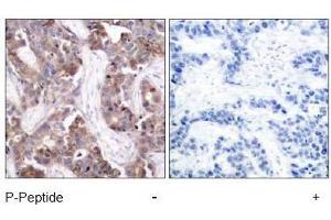 Image no. 1 for anti-Stathmin 1 (STMN1) (pSer24) antibody (ABIN196968) (Stathmin 1 抗体  (pSer24))