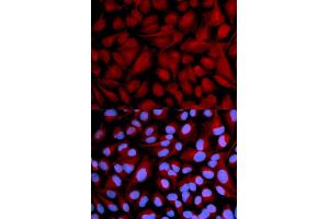 Immunofluorescence analysis of U2OS cells using CASK antibody (ABIN5971336). (CASK 抗体)