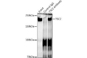 Immunoprecipitation analysis of 300 μg extracts of 293T cells using 3 μg TSC2 antibody (ABIN7271027). (Tuberin 抗体)