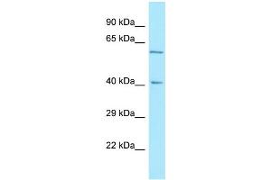 WB Suggested Anti-RTN4RL2 Antibody Titration: 1. (RTN4RL2 抗体  (C-Term))