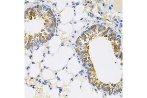 Immunohistochemistry of paraffin-embedded mouse lung using CEACAM5 antibody (ABIN6291892) (40x lens). (CEACAM5 抗体)