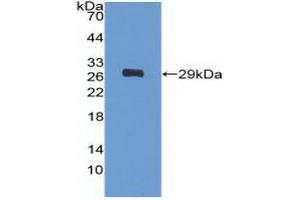 Detection of Recombinant PDGFRa, Human using Polyclonal Antibody to Platelet Derived Growth Factor Receptor Alpha (PDGFRa) (PDGFRA 抗体  (AA 170-387))