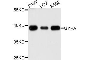 Western blot analysis of extracts of various cells, using GYPA antibody. (CD235a/GYPA 抗体)