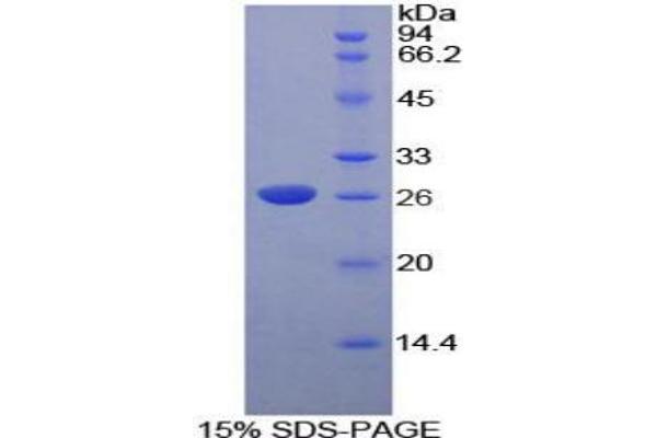 DNASE1L2 蛋白