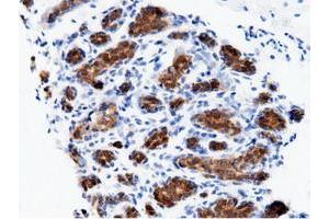 Immunohistochemical staining of paraffin-embedded Human breast tissue using anti-AK5 mouse monoclonal antibody. (Adenylate Kinase 5 抗体)