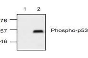 Image no. 1 for anti-Tumor Protein P53 (TP53) (pSer15) antibody (ABIN127171) (p53 抗体  (pSer15))