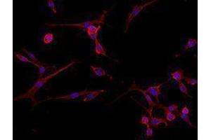 Immunofluorescence (IF) image for Goat anti-Rat IgG antibody (Alexa Fluor 594) (ABIN2667001) (山羊 anti-大鼠 IgG Antibody (Alexa Fluor 594))
