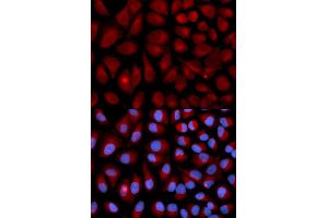 Immunofluorescence analysis of U2OS cells using VIM antibody (ABIN5971408). (Vimentin 抗体)