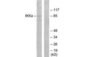 Western blot analysis of extracts from 293 cells, treated with EGF, using IKK-alpha (Ab-23) Antibody. (IKK alpha 抗体  (AA 15-64))