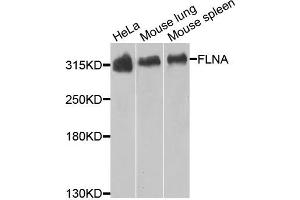 Western blot analysis of extracts of various cells, using FLNA antibody. (Filamin A 抗体)