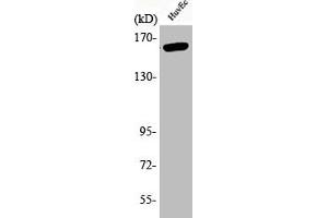 Western Blot analysis of HuvEc cells using Phospho-Flk-1 (Y1175) Polyclonal Antibody (VEGFR2/CD309 抗体  (pTyr1175))