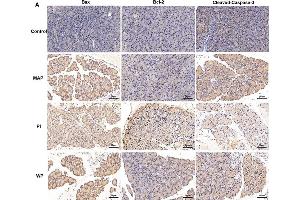 Immunohistochemistry (IHC) image for anti-B-Cell CLL/lymphoma 2 (BCL2) (N-Term) antibody (ABIN2857047)