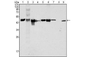 Western Blot showing CK18 antibody used against Hela (1), NIH/3T3 (2), A549 (3), Jurkat (4), MCF-7 (5), HepG2 (6), A431 (7), HEK293 (8) and K562 (9) cell lysate. (Cytokeratin 18 抗体  (AA 391-483))