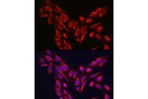 Immunofluorescence analysis of U-2 OS cells using PINK1 Rabbit pAb (ABIN6128457, ABIN6145665, ABIN6145667 and ABIN6215214) at dilution of 1:250 (40x lens). (PINK1 抗体  (AA 282-581))