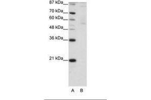 Image no. 1 for anti-Zinc Finger Protein 92 (ZNF92) (C-Term) antibody (ABIN203189) (ZNF92 抗体  (C-Term))