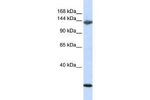 WB Suggested Anti-JAG2 Antibody Titration:  0. (JAG2 抗体  (N-Term))