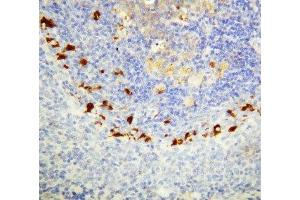 IHC-P: SOCS1 antibody testing of rat spleen tissue (SOCS1 抗体  (C-Term))