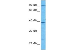 Host:  Rabbit  Target Name:  PLMN  Sample Type:  Jurkat Whole Cell lysates  Antibody Dilution:  1. (PLG 抗体  (Middle Region))