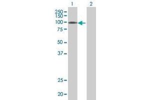 Western Blotting (WB) image for HKR3 293T Cell Transient Overexpression Lysate(Denatured) (ABIN1332123)