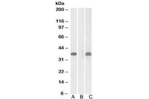 Western blot testing of HEK293 lysate overexpressing human PIM2-MYC with PIM2 antibody (1ug/ml) in Lane A and anti-MYC (1/1000) in lane C. (PIM2 抗体)