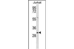 Western blot analysis in Jurkat cell line lysates (35ug/lane). (TMED8 抗体  (AA 154-182))
