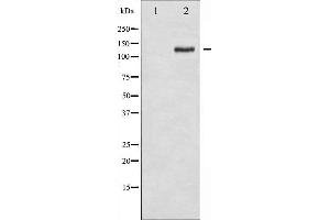 Western blot analysis of FAK phosphorylation expression in 293 whole cell lysates,The lane on the left is treated with the antigen-specific peptide. (FAK 抗体  (pTyr925))