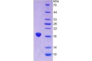 SDS-PAGE (SDS) image for Glial Fibrillary Acidic Protein (GFAP) ELISA Kit (ABIN6574132)