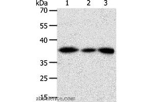 Western blot analysis of Human liver cancer tissue, hela cell and human fetal kidney tissue, using AKR1A1 Polyclonal Antibody at dilution of 1:450 (AKR1A1 抗体)