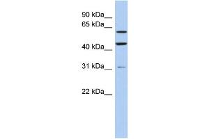 WB Suggested Anti-ZNF179 Antibody Titration:  0. (RNF112 抗体  (Middle Region))