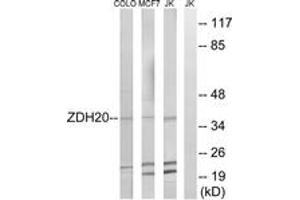 Western blot analysis of extracts from Jurkat/MCF-7/COLO cells, using ZDHHC20 Antibody. (ZDHHC20 抗体  (AA 72-121))