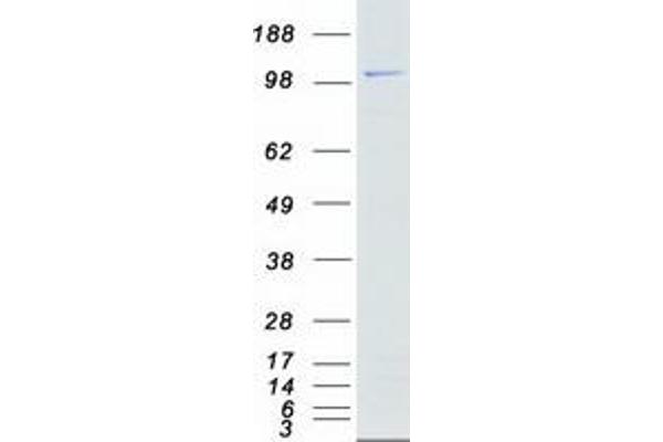 STK31 Protein (Transcript Variant 1) (Myc-DYKDDDDK Tag)