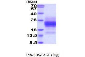 SDS-PAGE (SDS) image for Glycophorin A (GYPA) (AA 20-91) protein (His tag) (ABIN5854899) (CD235a/GYPA Protein (AA 20-91) (His tag))