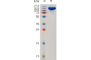 ROBO1 Protein (AA 26-897) (Fc Tag)