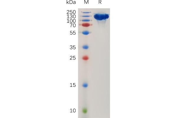 ROBO1 Protein (AA 26-897) (Fc Tag)