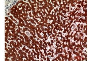 Immunohistochemical analysis of paraffin-embedded human-liver, antibody was diluted at 1:100. (HSD11B1 抗体  (N-Term))